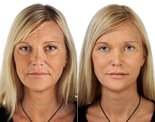 5 ideias de títulos:
1. Sebo de Carneiro: O Guia Completo para Hidratação e Alívio Muscular
2. Descubra os Benefícios Incríveis do Sebo de Carneiro para sua Pele
3. Sebo de Carneiro: Como Usar para Tratar Pés Rachados e Dores Musculares
4. Ingredientes e Usos do Sebo de Carneiro: O Que Você Precisa Saber
5. Sebo de Carneiro no Esporte: Acelere sua Recuperação Muscular