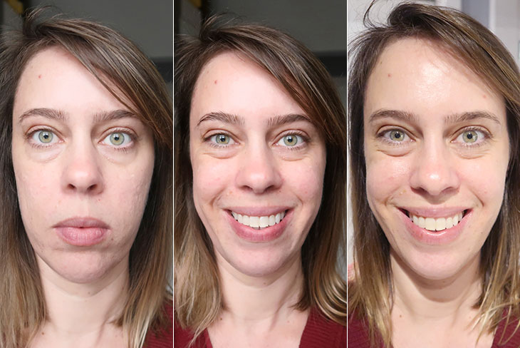 passar bepantol no rosto