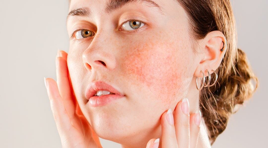 Skincare Essencial para Peles Sensíveis: Produtos e Rotinas Recomendadas