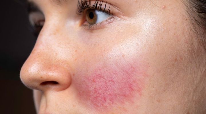 Skincare Essencial para Peles Sensíveis: Produtos e Rotinas Recomendadas