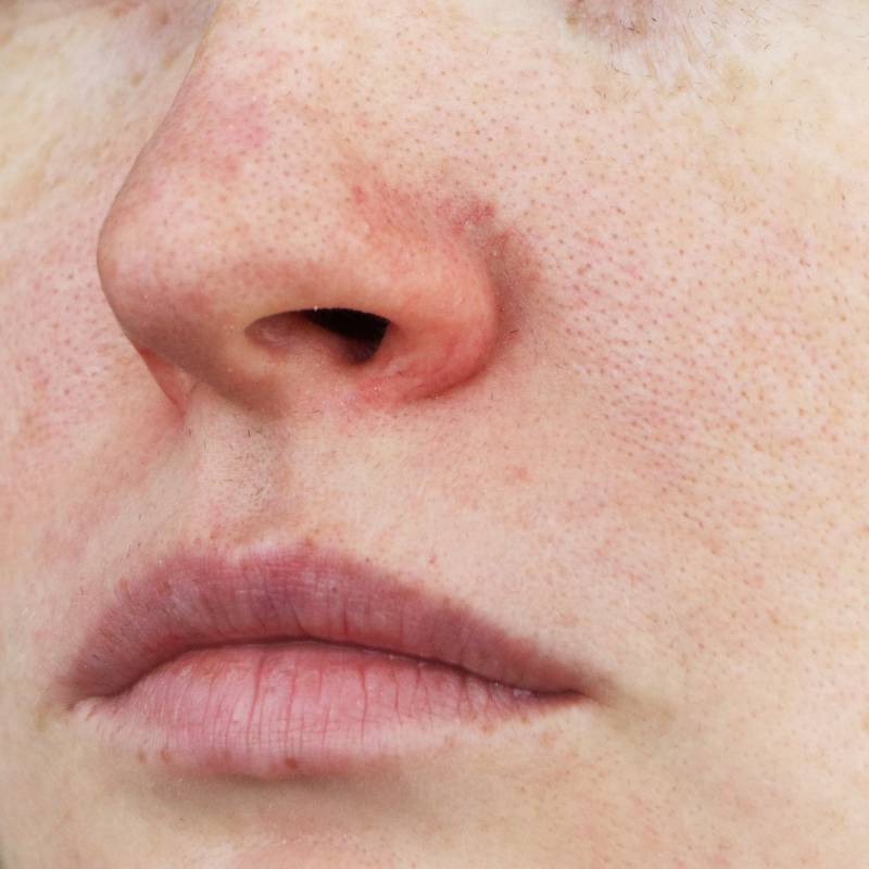 5 Melhores Esfoliantes para Textura da Pele