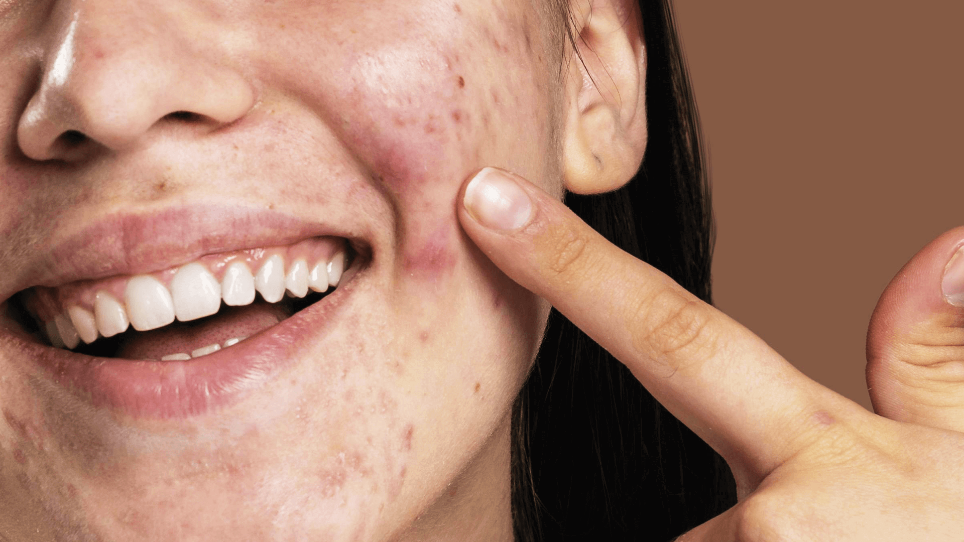 Como o Retinol Transforma a Textura da Sua Pele