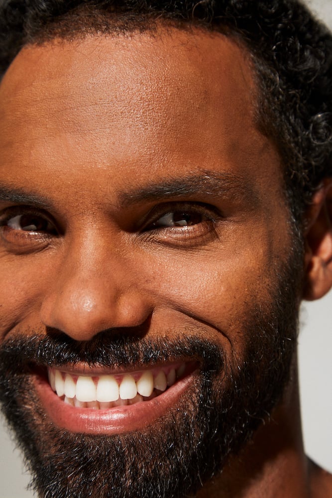 Tratamentos Profissionais para Cicatrizes de Acne