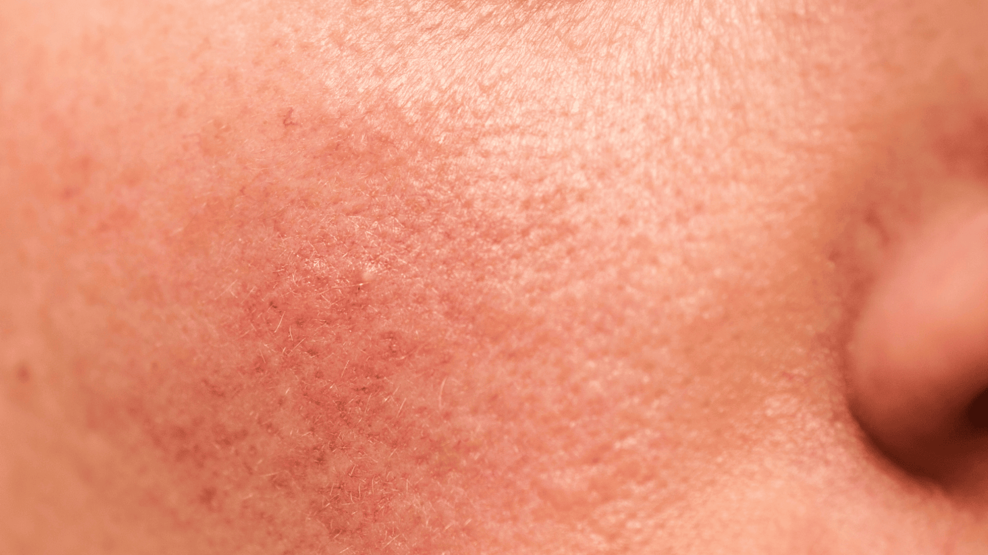 Vitamina C: O Segredo para uma Pele Luminosa e Uniforme