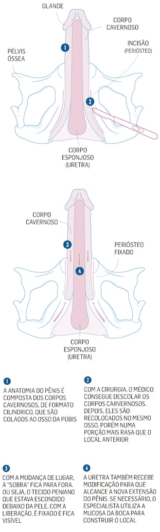 5 ideias de títulos:
1. Entendendo o Termo 