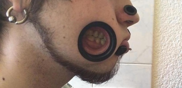 5 ideias de títulos: Os Perigos Ocultos do Piercing na Bochecha: Um Guia Completo; Piercing de Covinha: Tradicional vs. Microdermal - Qual o Melhor para Você?; Guia Essencial de Cuidados Pós-Piercing na Bochecha para uma Cicatrização Saudável; Anatomia Facial e Piercing na Bochecha: Entenda os Riscos e Estruturas Vitais; Titânio G23 e Outros Materiais: Escolhendo a Joia Certa para seu Piercing na Bochecha