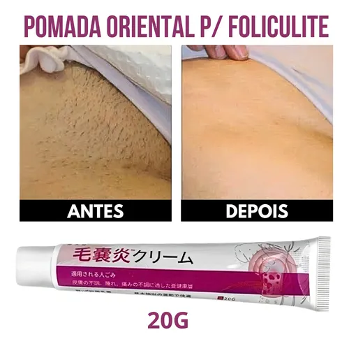 tratamentos dermatológicos para inflamação capilar