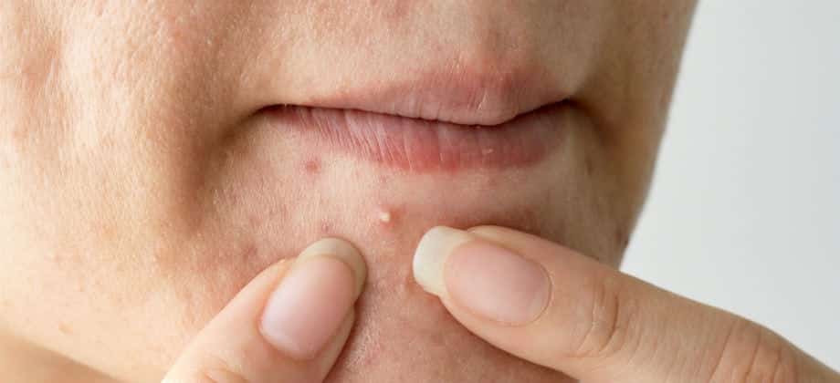 Sintomas e Melhores Tratamentos