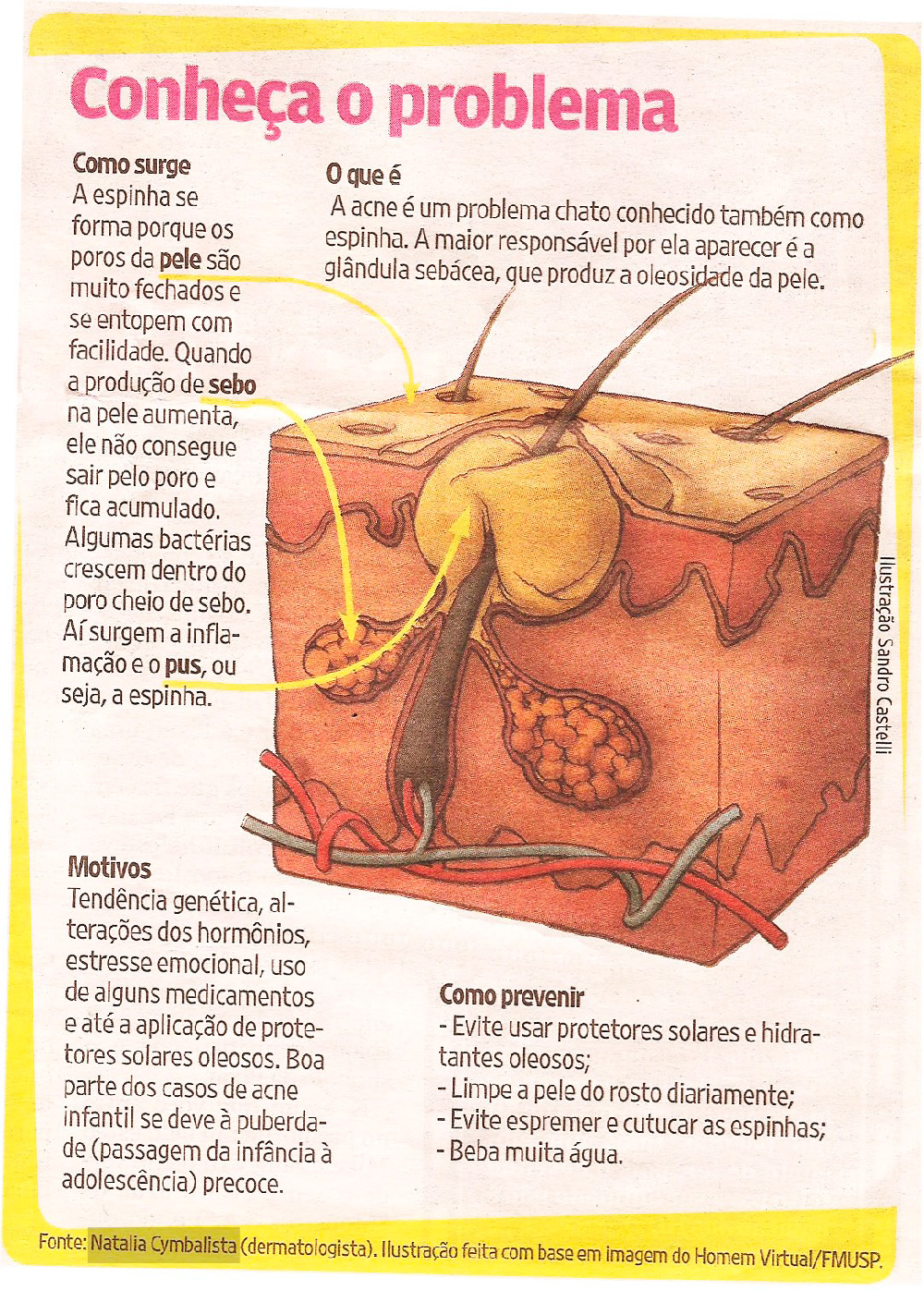 Medicamentos que Podem Causar Acne: O Que Você Precisa Saber