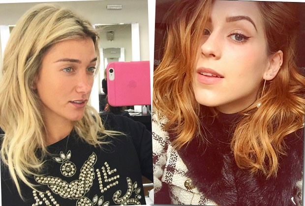 qual hormônio faz nascer cabelo feminino