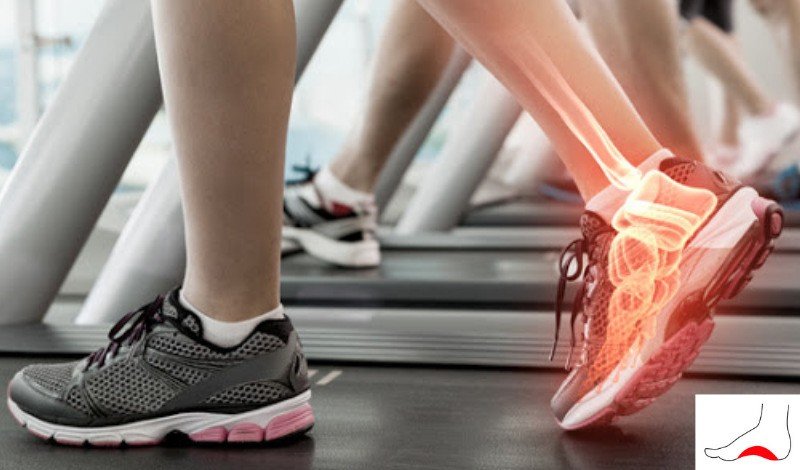 Reebok Nano X5 vs Nike Metcon 10: Comparativo para Mulheres