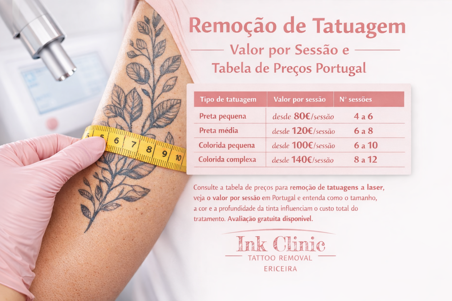 remoção de tatuagem a laser preço sp