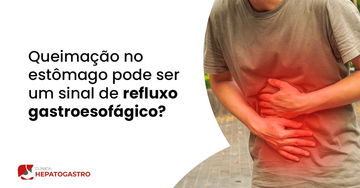 Queimacao No Estomago