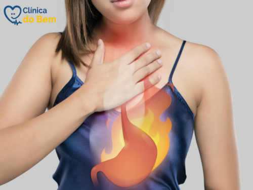 Queimacao No Estomago