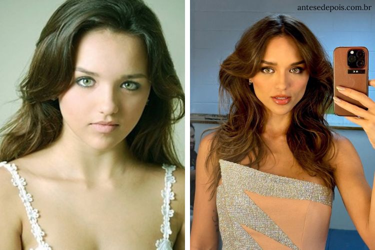 rafa kalimann antes e depois fotos