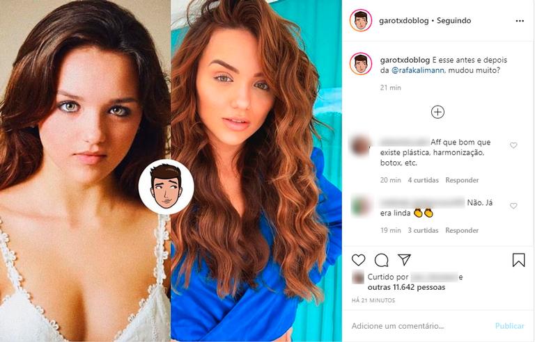 rafa kalimann antes e depois fotos