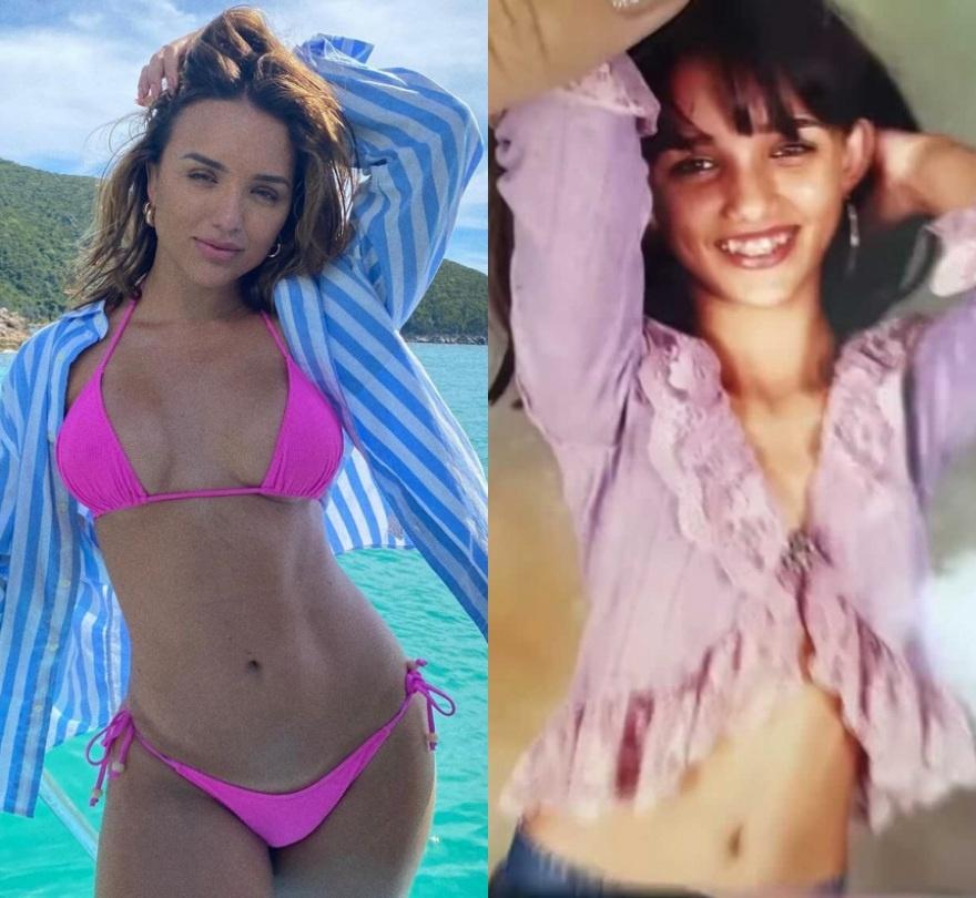 rafa kalimann bichectomia antes e depois