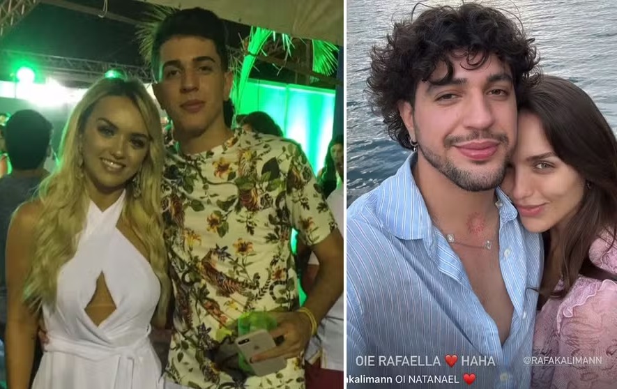 rafa kalimann preenchimento labial antes e depois
