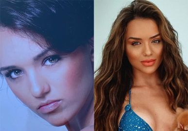 rafa kalimann silicone antes e depois