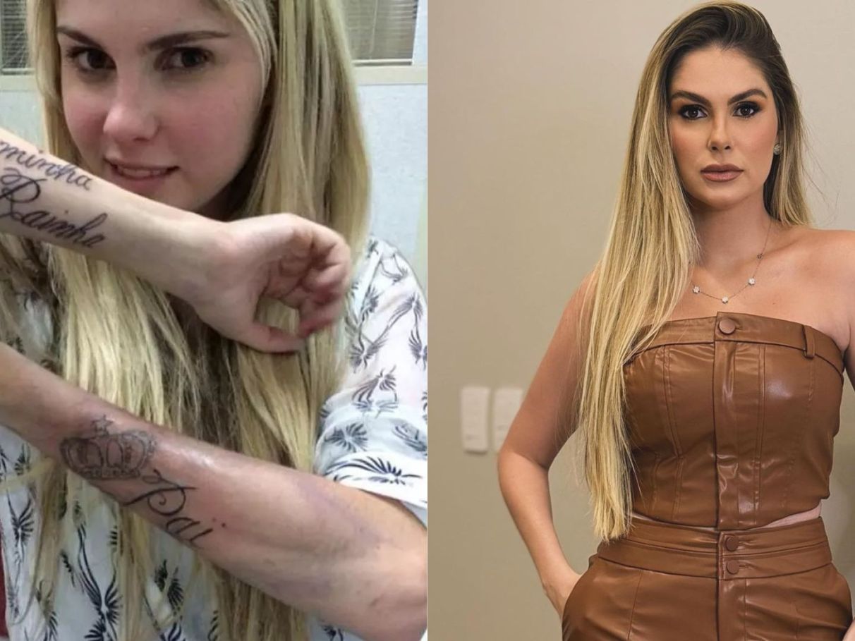 remoção de tatuagem colorida