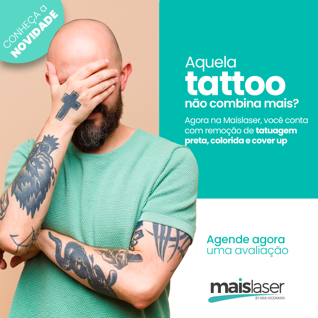 remoção de tatuagem preta