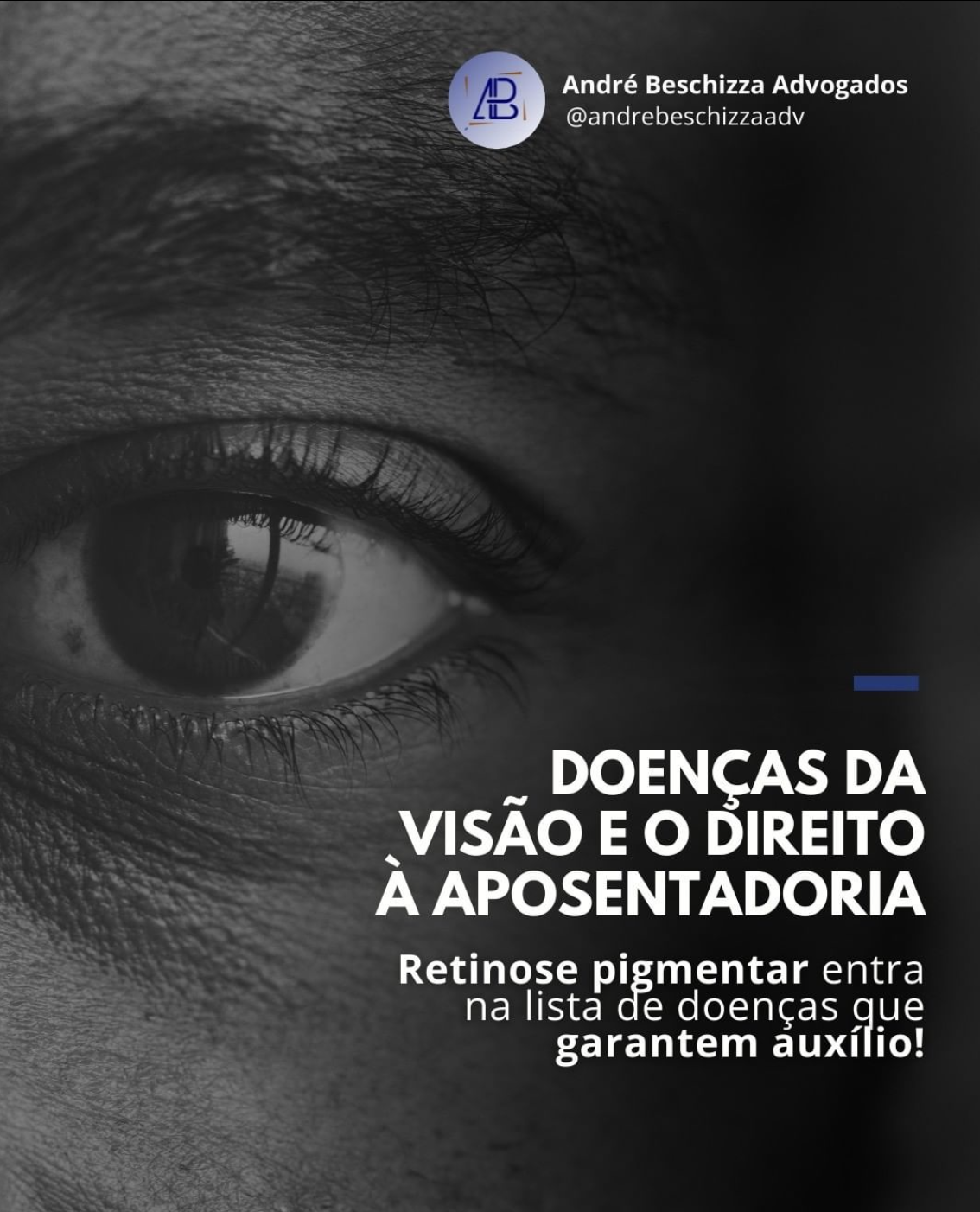 retinose pigmentar aposentadoria