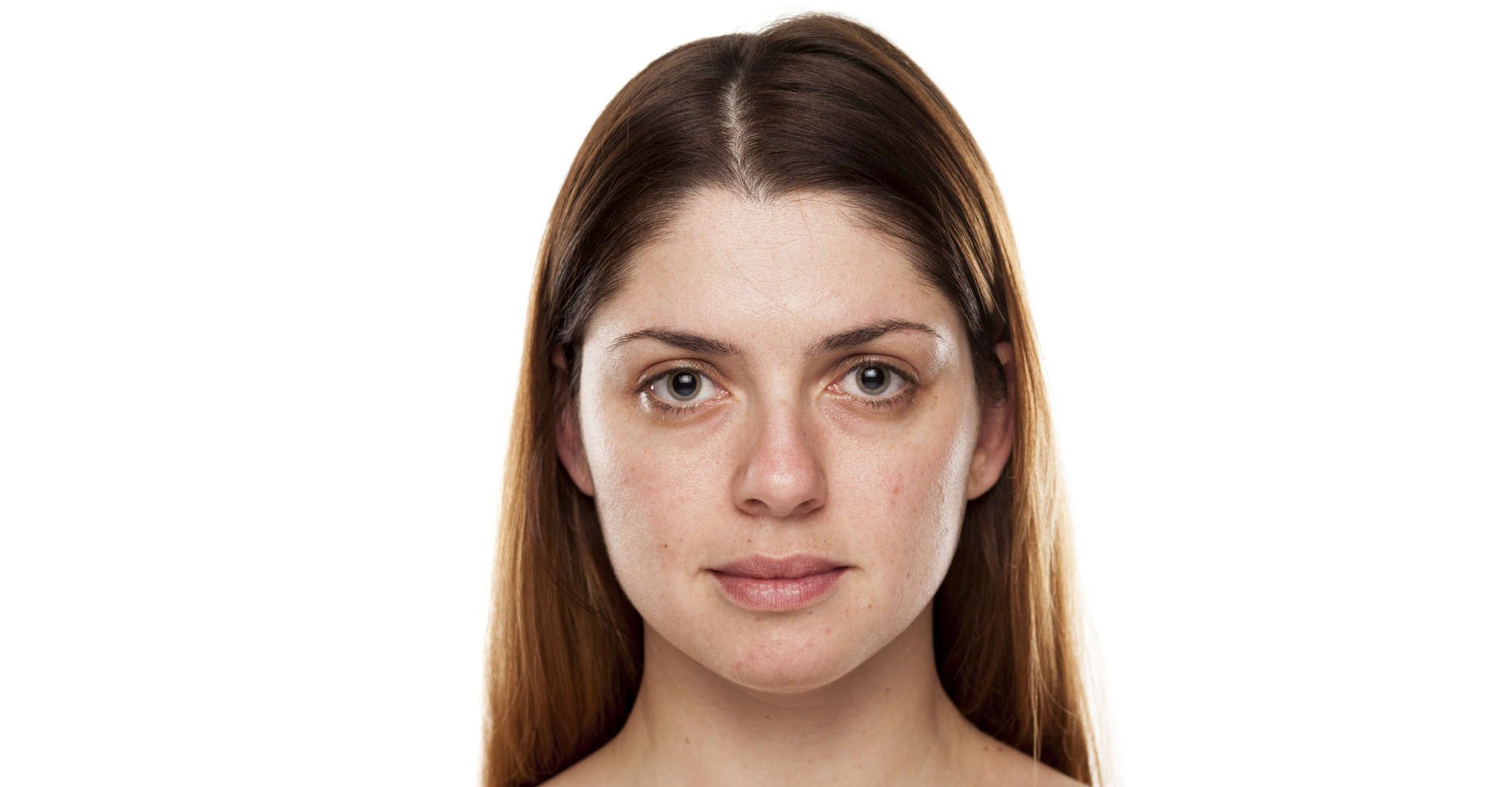 5 ideias de títulos:
1. Rosto Cansado: As Causas Ocultas e Soluções Definitivas
2. Desvendando o Olhar Cansado: Da Perda de Colágeno aos Procedimentos Estéticos
3. Guia Completo: Como Combater o Rosto Cansado com Skincare e Tratamentos
4. Flacidez Facial e Olheiras: Entenda a Relação com o Rosto Cansado
5. Dicas Práticas e Profissionais para Rejuvenescer o Olhar e o Rosto