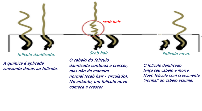 Transição Capilar: O Papel do Big Chop no Tratamento do Scab Hair
