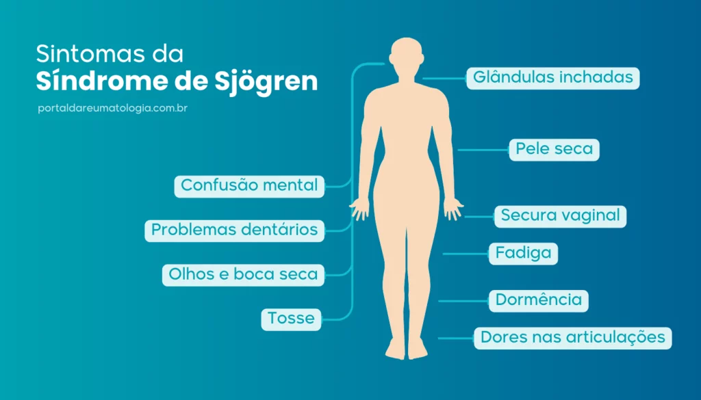 alívio dos sintomas de Sjögren