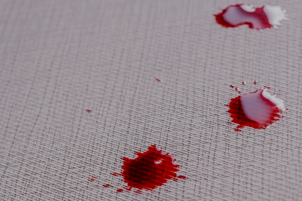 sonhar com sangue saindo do nariz o que não fazer