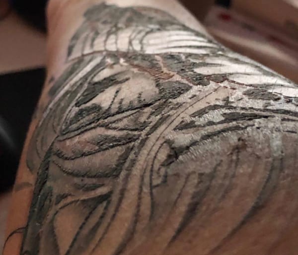 o que fazer quando a tatuagem está descascando