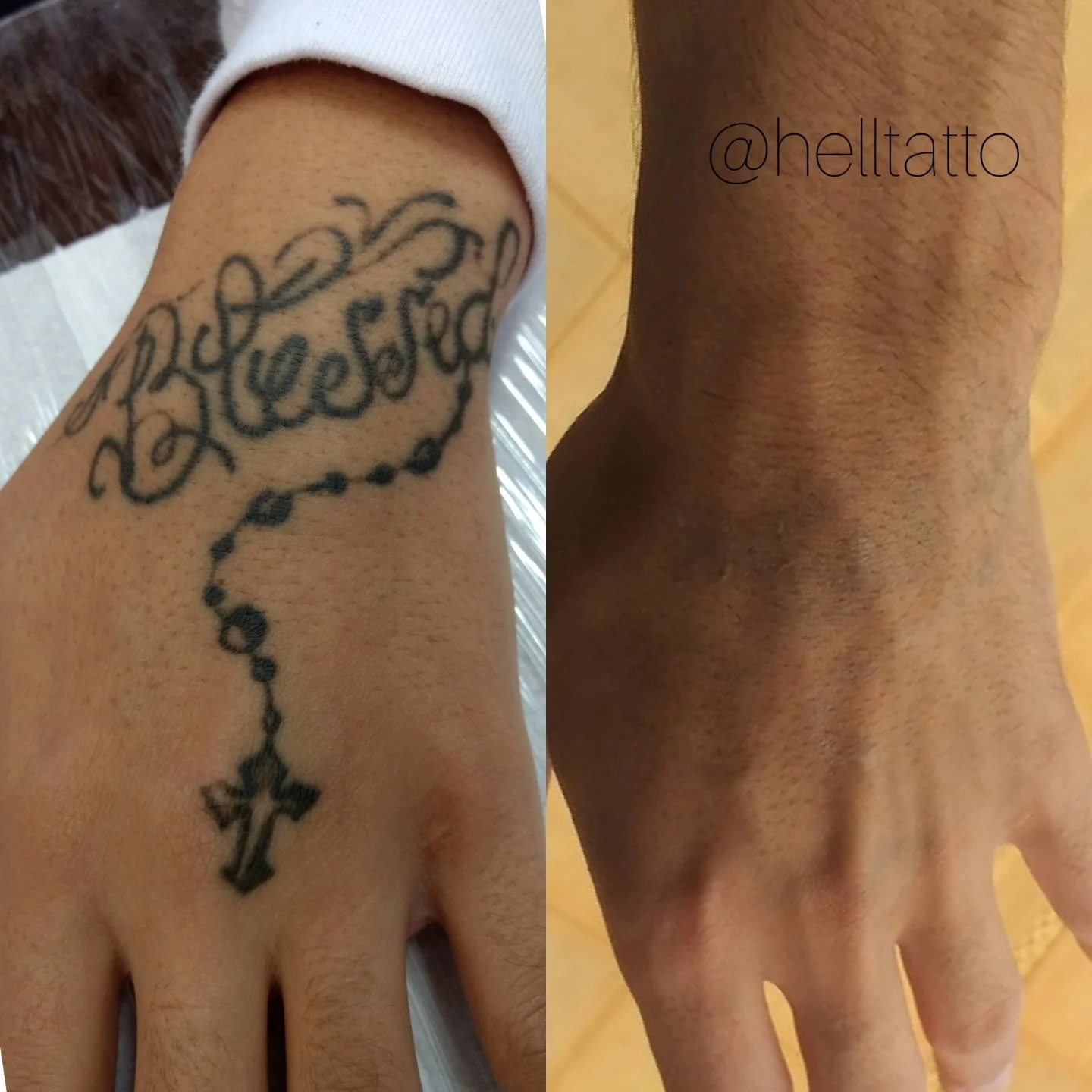 tatuagem blackwork pele negra