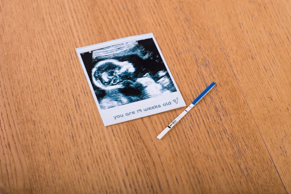 Entenda o Hormônio hCG: O Verdadeiro Marcador da Gravidez