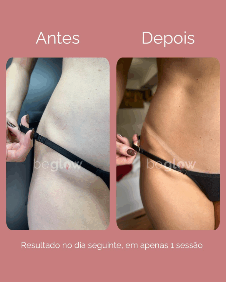 1. Bronzeamento Natural: Riscos e Benefícios da Exposição ao Sol
2. Bronzeamento a Jato: Como Funciona e Duração
3. Autobronzeadores: Guia Completo para um Bronzeado Perfeito em Casa
4. Bronzeamento Artificial: Por Que é Proibido e Alternativas Seguras
5. Preparação da Pele para o Bronzeamento: Dicas Essenciais