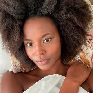 5 ideias de títulos:
1. Guia Completo: Como Identificar o Subtom da Sua Pele Negra
2. Pele Negra: Desvendando os Fototipos e Cuidados Essenciais
3. Skincare para Pele Negra Oleosa: Dicas e Produtos Recomendados
4. Foliculite e Queloides na Pele Negra: Causas e Tratamentos Eficazes
5. A Importância do Protetor Solar para Prevenir Hiperpigmentação na Pele Negra