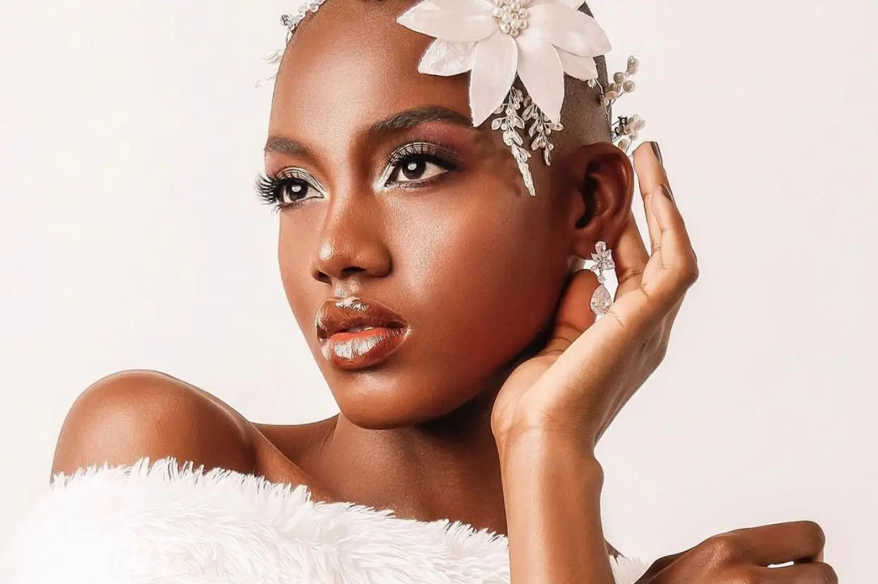 5 ideias de títulos:
1. Guia Completo: Como Identificar o Subtom da Sua Pele Negra
2. Pele Negra: Desvendando os Fototipos e Cuidados Essenciais
3. Skincare para Pele Negra Oleosa: Dicas e Produtos Recomendados
4. Foliculite e Queloides na Pele Negra: Causas e Tratamentos Eficazes
5. A Importância do Protetor Solar para Prevenir Hiperpigmentação na Pele Negra
