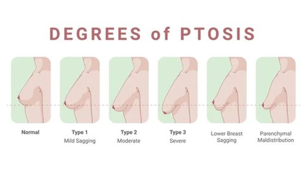 Como Escolher o Sutiã Ideal para Cada Tipo de Seio