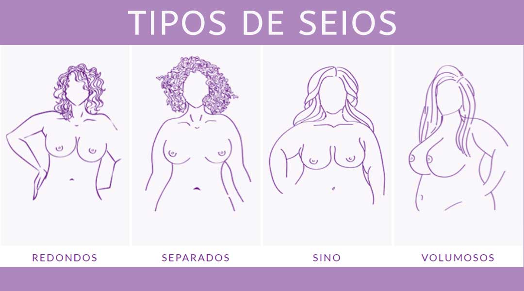 Assimetria Mamária e Seios Tuberosos: Entenda as Variações Comuns