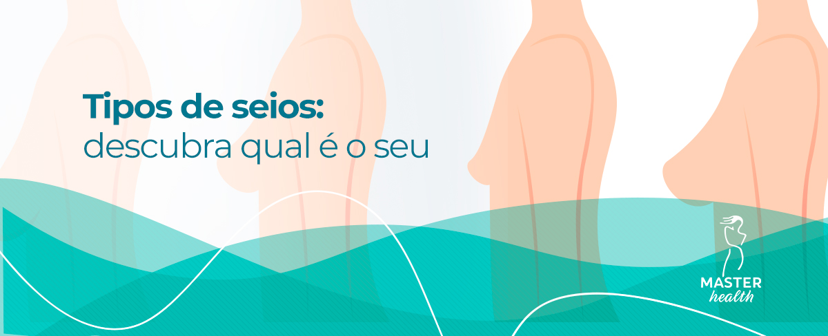Como Escolher o Sutiã Ideal para Cada Tipo de Seio