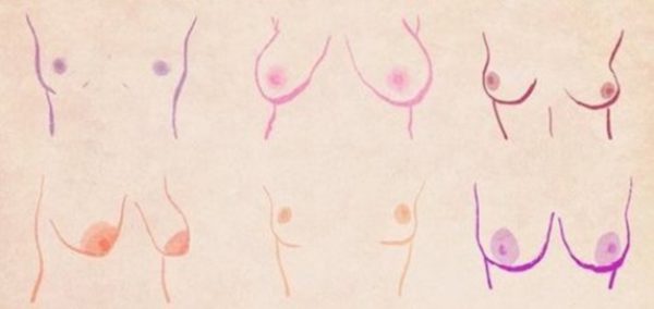 Mamilos e Densidade Mamária: Fatores que Definem a Individualidade dos Seios