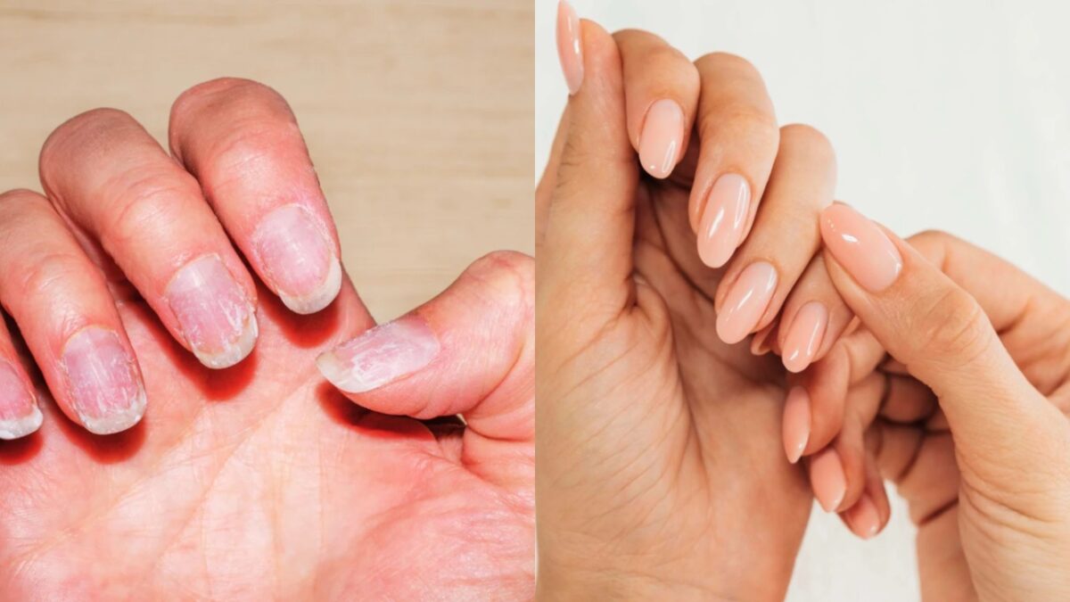 Alongamento de Unhas com Sal: Guia Completo e Riscos