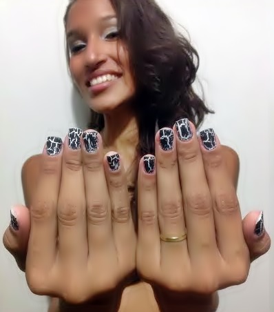 Como Tratar Fungos nas Unhas dos Pés com Banhos de Sal e Vinagre