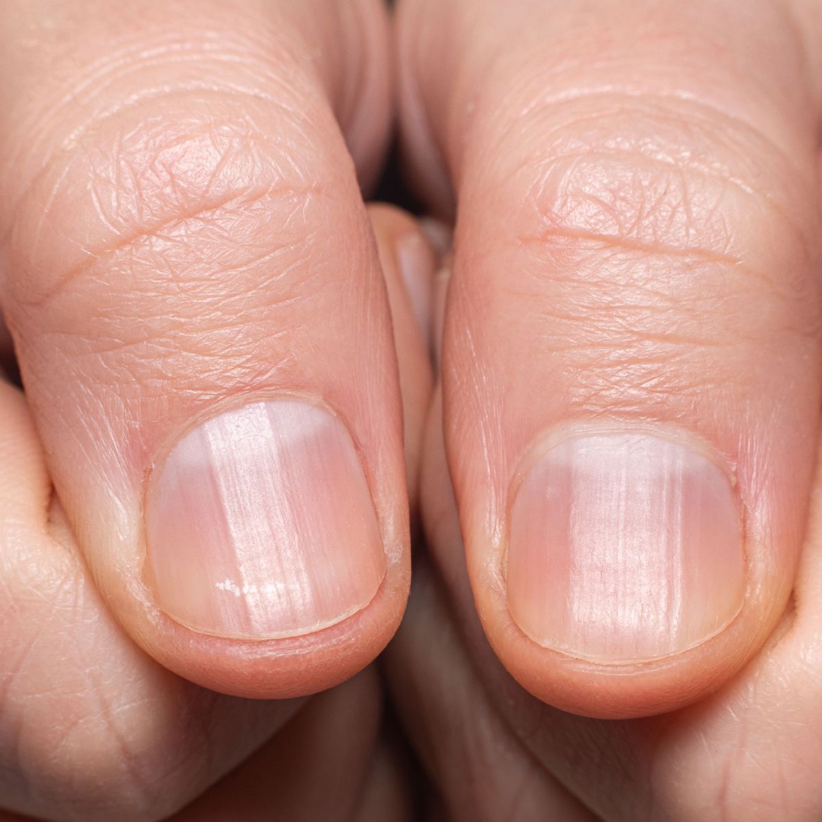Biotina para Unhas: Guia Completo de Suplementação e Benefícios
