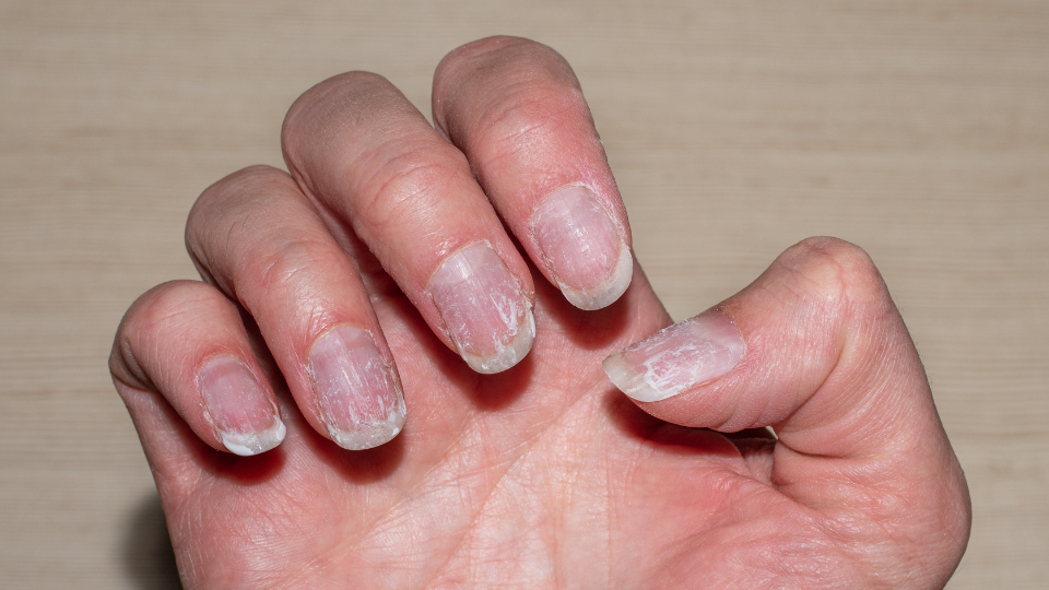 Biotina para Unhas: Guia Completo de Suplementação e Benefícios