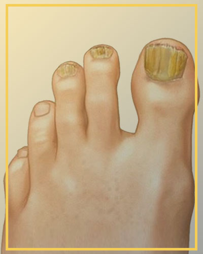 Como a Desidratação Afeta a Saúde das Suas Unhas e Como Reverter