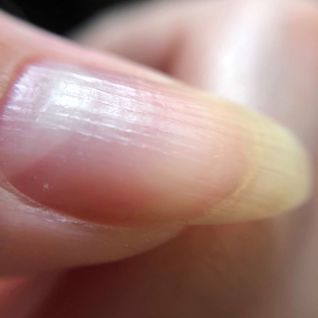 5 Dicas para Hidratar Unhas Ressecadas