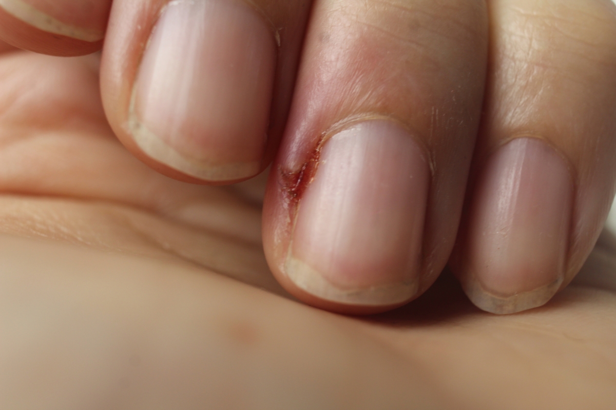 Melhores Bases Niveladoras para Unhas Estriadas