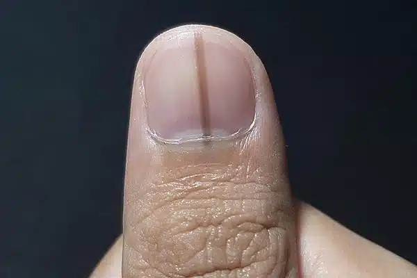 5 Dicas para Hidratar Unhas Ressecadas