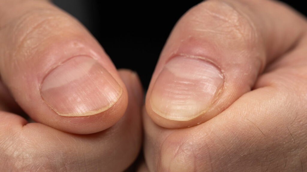 Nutrientes Essenciais para Unhas Fortes