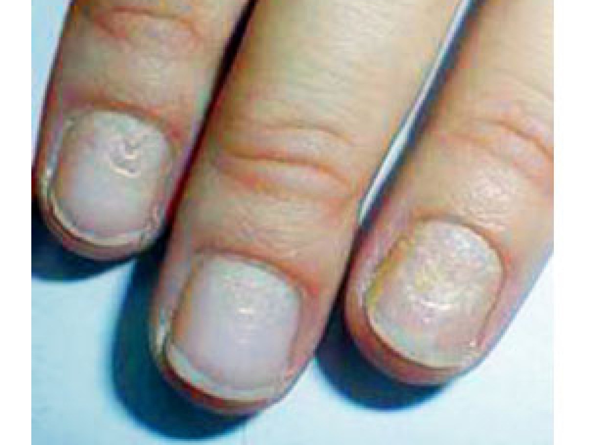 5 Dicas para Hidratar Unhas Ressecadas